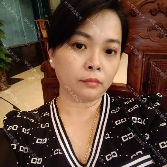 张阿姨